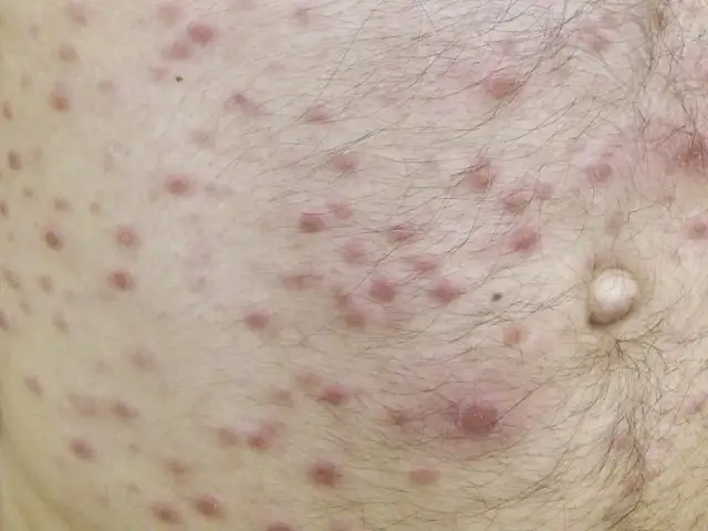 Blady jak ściana: co oznacza i jakie są jego przyczyny?