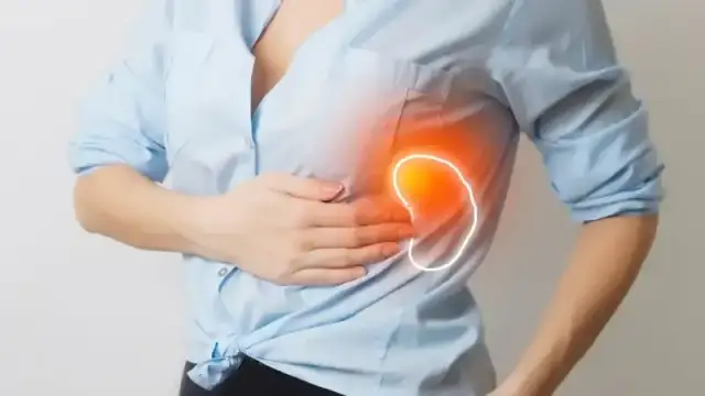 Co na ból śledziony: poznaj przyczyny i skuteczne metody leczenia