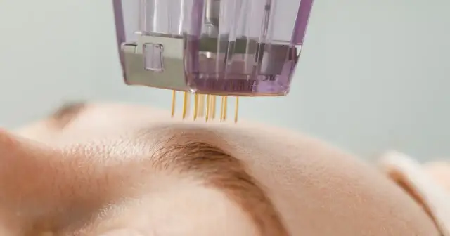 Mezoterapia igłowa - efekty, bezpieczeństwo, dla kogo ma sens?