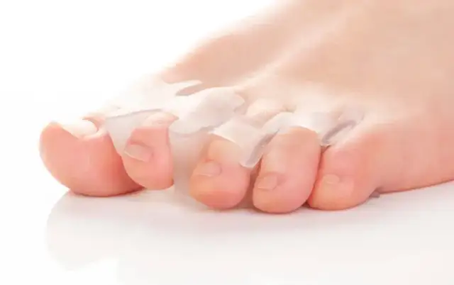 Czy separatory na haluksy działają? Poznaj prawdę i skuteczne metody