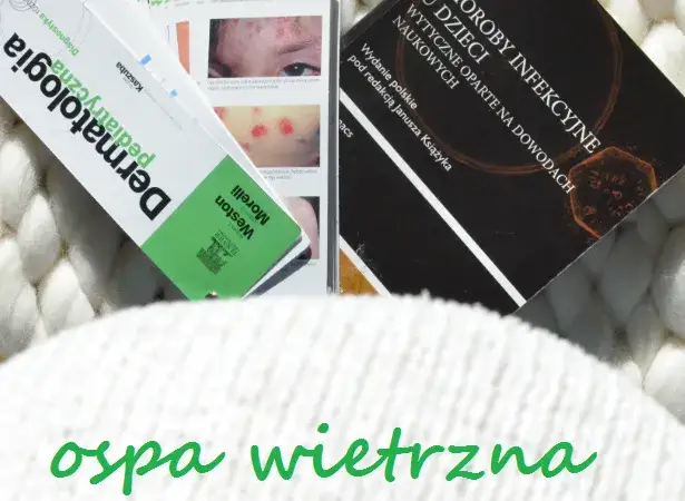 Czy rodzeństwo dziecka z ospą może chodzić do przedszkola bez ryzyka?