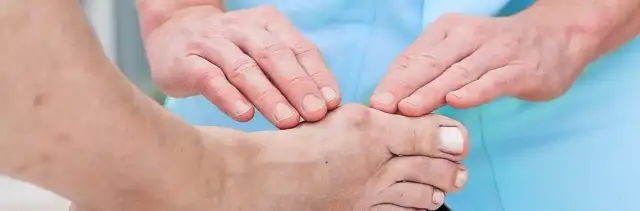 Jakie ćwiczenia po operacji palucha sztywnego pomogą w rehabilitacji?