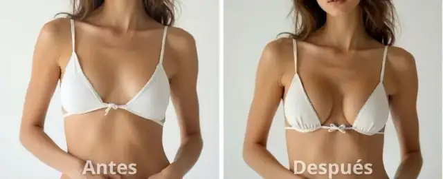 Ácido hialurónico pecho antes y después: resultados sorprendentes y reales