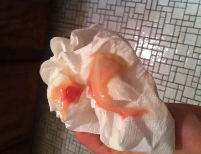 Wypadł czop śluzowy – ile czasu do porodu i co to oznacza?