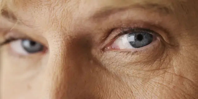 Zaćma objawy forum: Jak rozpoznać wczesne symptomy zaćmy?