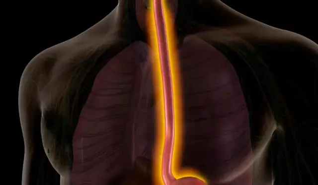 Rak przełyku: objawy, które musisz znać. Sprawdź!