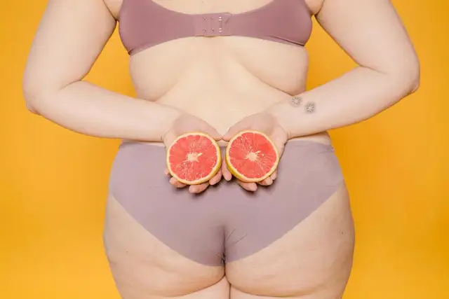 Co naprawdę działa na cellulit? Skuteczne metody, które przynoszą efekty