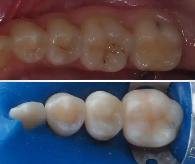 Plombowanie krok po kroku - skuteczne metody dla bezpieczeństwa