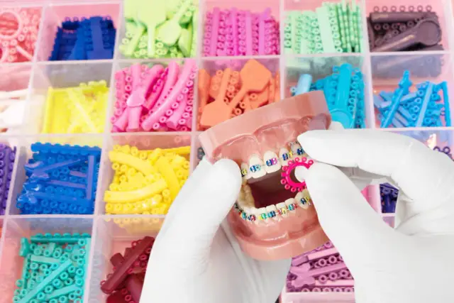 Jakie gumki do aparatu wybielają zęby? Odkryj kolory, które działają