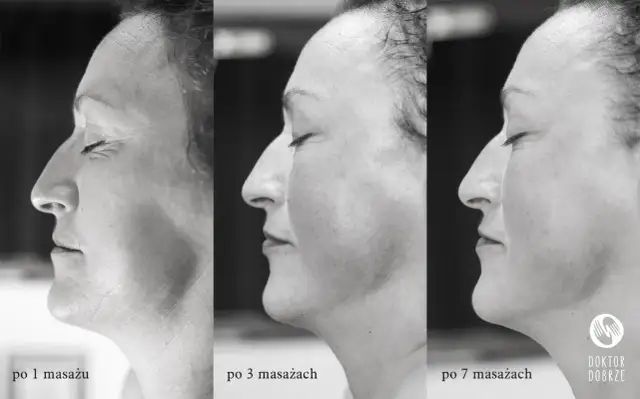 Masaż Kobido: Naturalny lifting twarzy? Poznaj efekty i etapy