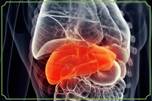 Podwyższone ALT i AST? Obniż enzymy wątrobowe naturalnie!