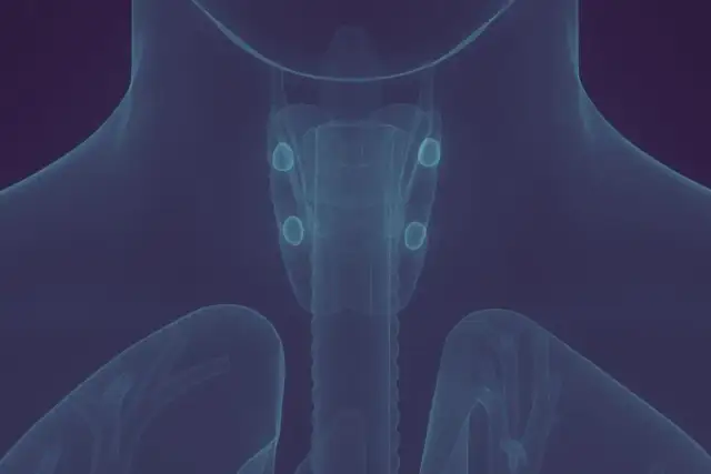 Nadczynność przytarczyc objawy psychiczne: jak je rozpoznać i leczyć