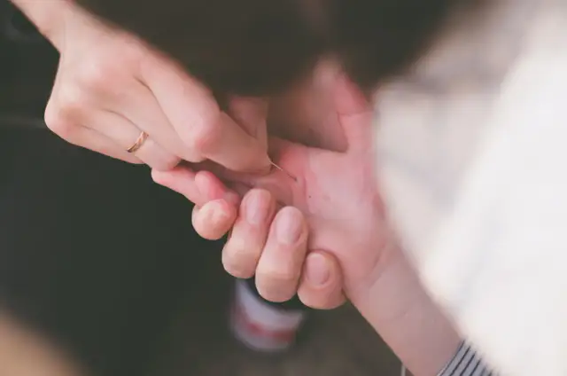 Bolesna drzazga pod paznokciem? Poznaj triki na bezbolesne usunięcie