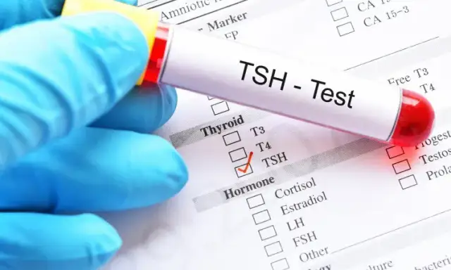 Badanie TSH: Co musisz wiedzieć o zdrowiu tarczycy?