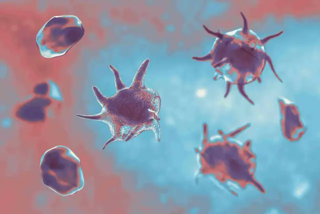 Niskie płytki krwi w morfologii: przyczyny, objawy i co dalej?