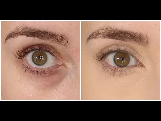 Jak zatuszować worki pod oczami? Makijaż krok po kroku!