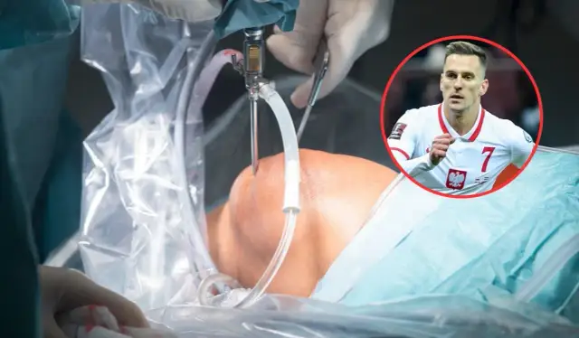 Najszybsza artroskopia kolana NFZ – terminy i dostępność w Polsce