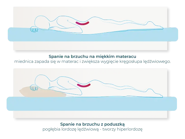 Jak spać po CC: pozycja na brzuchu z poduszką pod biodrami lub na plecach z poduszką pod kolanami.