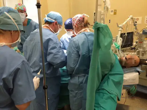 Pierwszy w Polsce przeszczep łańcuchowy nerek - historia i znaczenie