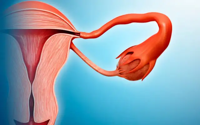 Sono-HSG: Badanie drożności jajowodów jak się przygotować i czy boli?