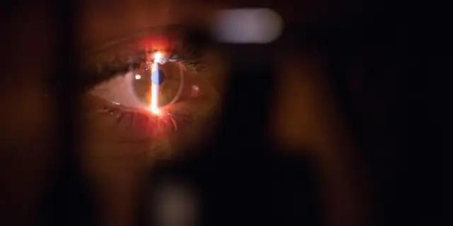 Ile czasu jest ważne skierowanie do okulisty? Uniknij problemów z wizytą