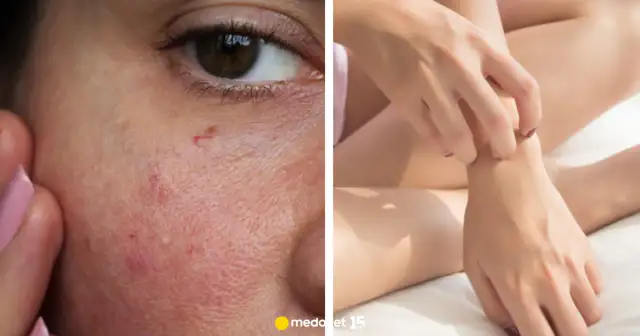 Niedobór wapnia: leki, objawy i witamina D3 przewodnik Sylwii Wróblewskiej