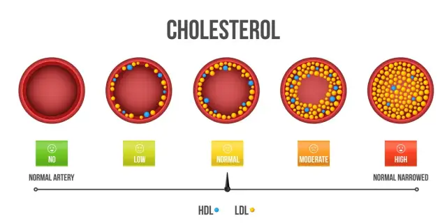 Jaki cholesterol jest dobry i jak poprawić jego poziom w organizmie