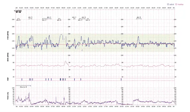 Co ile skurcze do porodu? Zrozum, kiedy zaczyna się prawdziwy ból