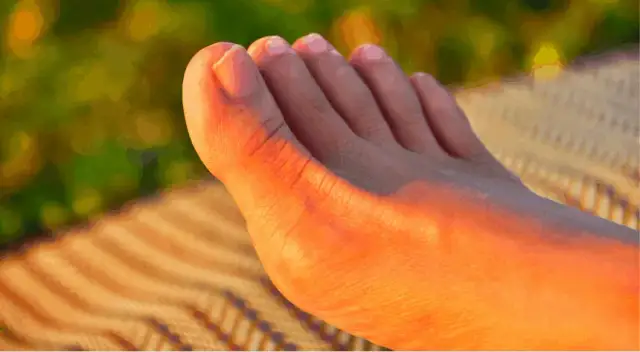 Jak wyprostować haluksy? Kompletny przewodnik po leczeniu i profilaktyce.