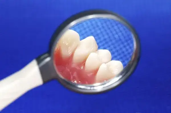 Co na bolące dziąsło od ósemki – skuteczne sposoby na ulgę i kiedy iść do dentysty
