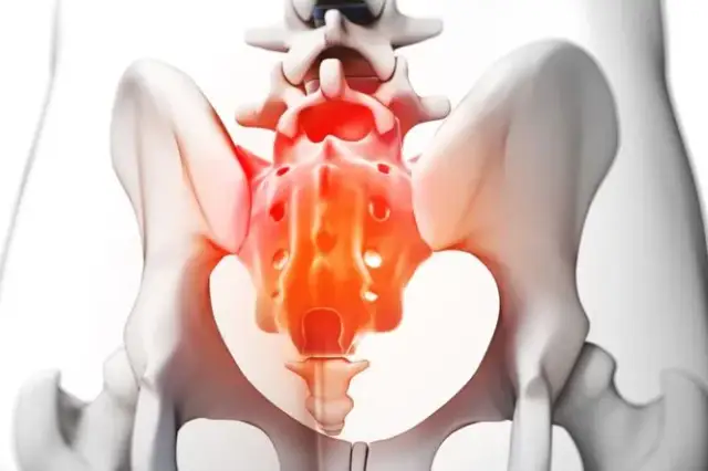 Jakie leki na ból kości ogonowej mogą przynieść ulgę w cierpieniu