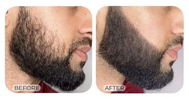 Jak zagęścić zarost na brodzie: sprawdzone metody i porady