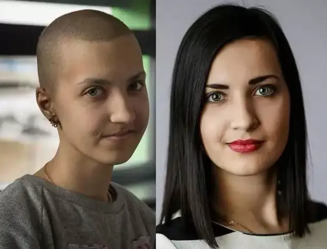 Po jakim czasie można farbować włosy po chemioterapii? Dowiedz się teraz!