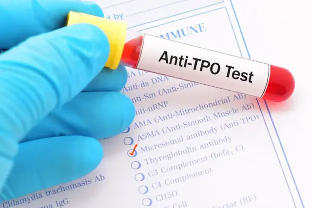 Anty-TPO: Wyniki, normy, Hashimoto. Rozwiej wątpliwości!