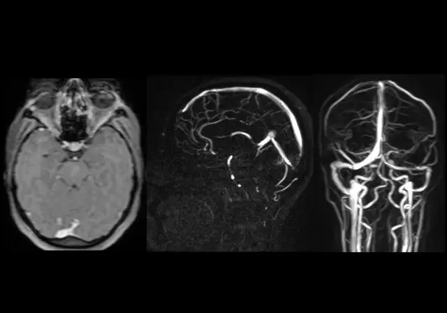 Zatoka skalista dolna - kluczowe informacje o jej funkcjach i znaczeniu