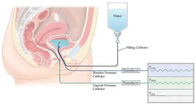 Badanie urodynamiczne w Polsce: Gdzie i jak je wykonać? NFZ czy prywatnie?