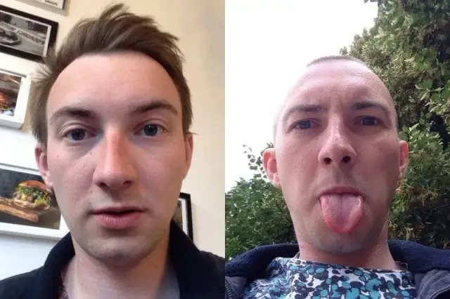 Czy łysina Ci pasuje? Sprawdź, zanim ogolisz głowę!