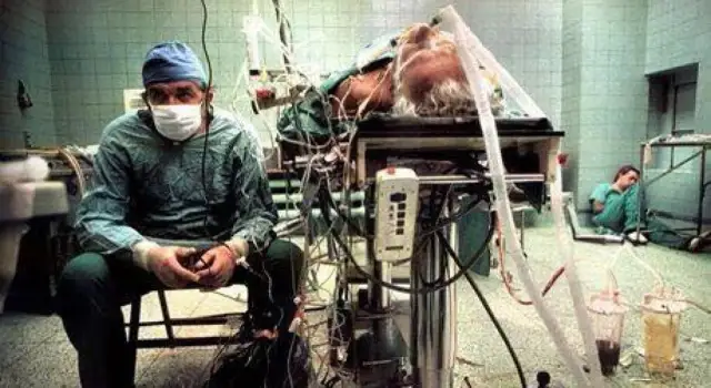 Ile trwał pierwszy przeszczep serca w Polsce i co to oznacza dla historii?