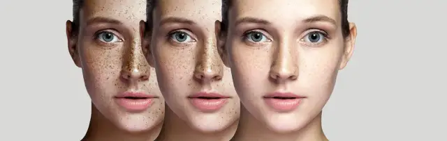 Jak rozjaśnić cerę? Składniki, zabiegi i domowe sposoby