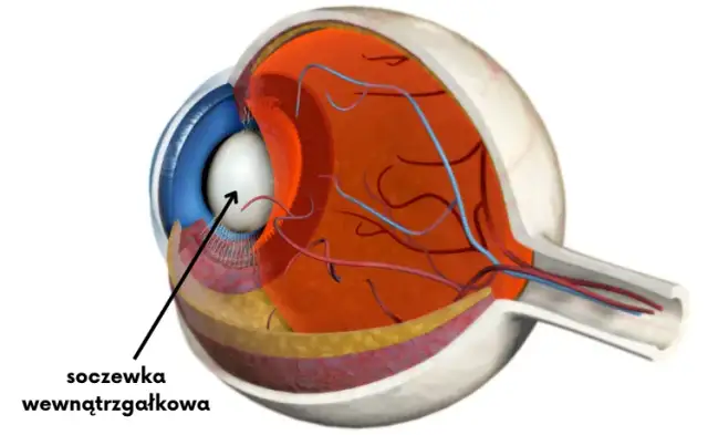 Soczewka: Jak działa i dlaczego jest kluczowa dla Twojego wzroku?