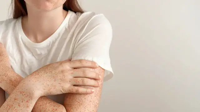 Alergia na nikiel w jamie ustnej 19% dorosłych cierpi. Poznaj objawy i leczenie