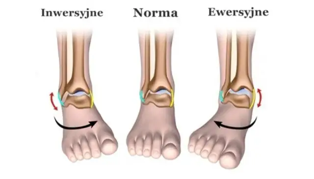 Skręcona kostka: Ile trwa leczenie? Czas gojenia i rehabilitacja