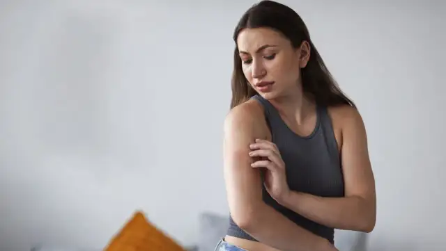 Kobieta drapie ramię, na którym widać zaczerwienienie. Czy to objaw somatyzacji?