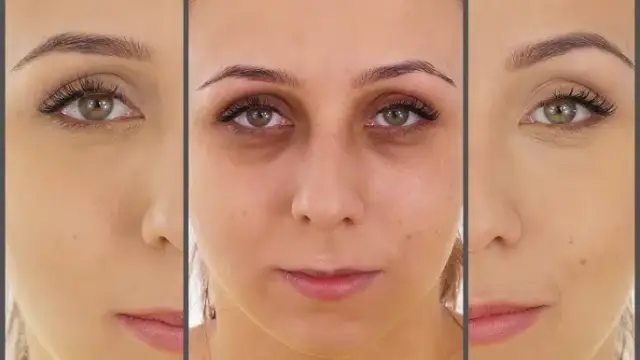 Korektor na sińce pod oczami: Jak wybrać i aplikować? Poradnik