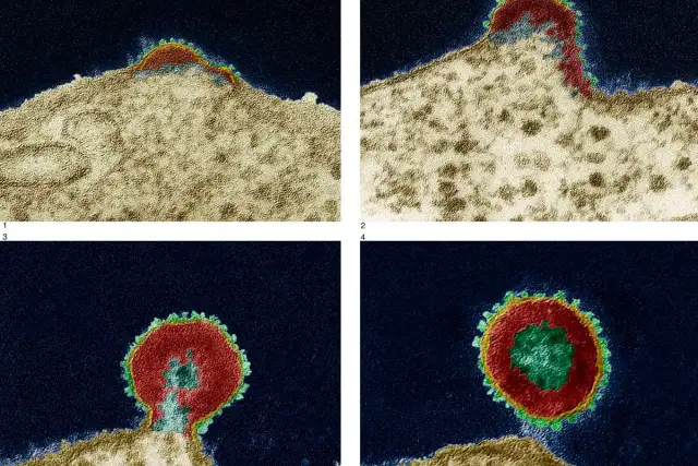 Skąd się wziął AIDS? Zaskakujące fakty o pochodzeniu wirusa HIV