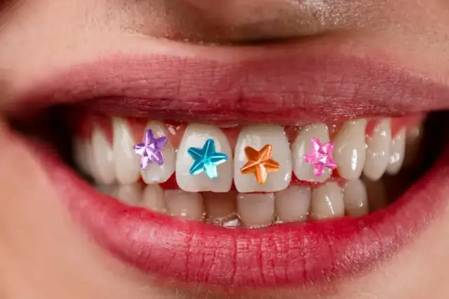 Biżuteria nazębna jak zrobić - uniknij błędów przy aplikacji
