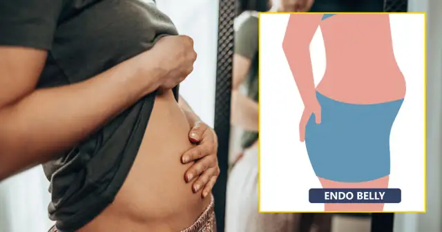 Endometrioza a menopauza: Czy to koniec bólu? Prawda i mity.