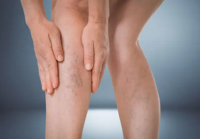 Czy lipofilling biustu się opłaca? Pełna analiza i porównanie