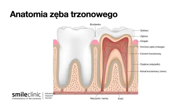 Ból po leczeniu kanałowym: normalne czy niepokojące? Poradnik