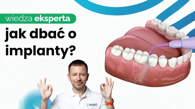 Ulga od bólu dziąseł pod protezą: Co działa naprawdę?